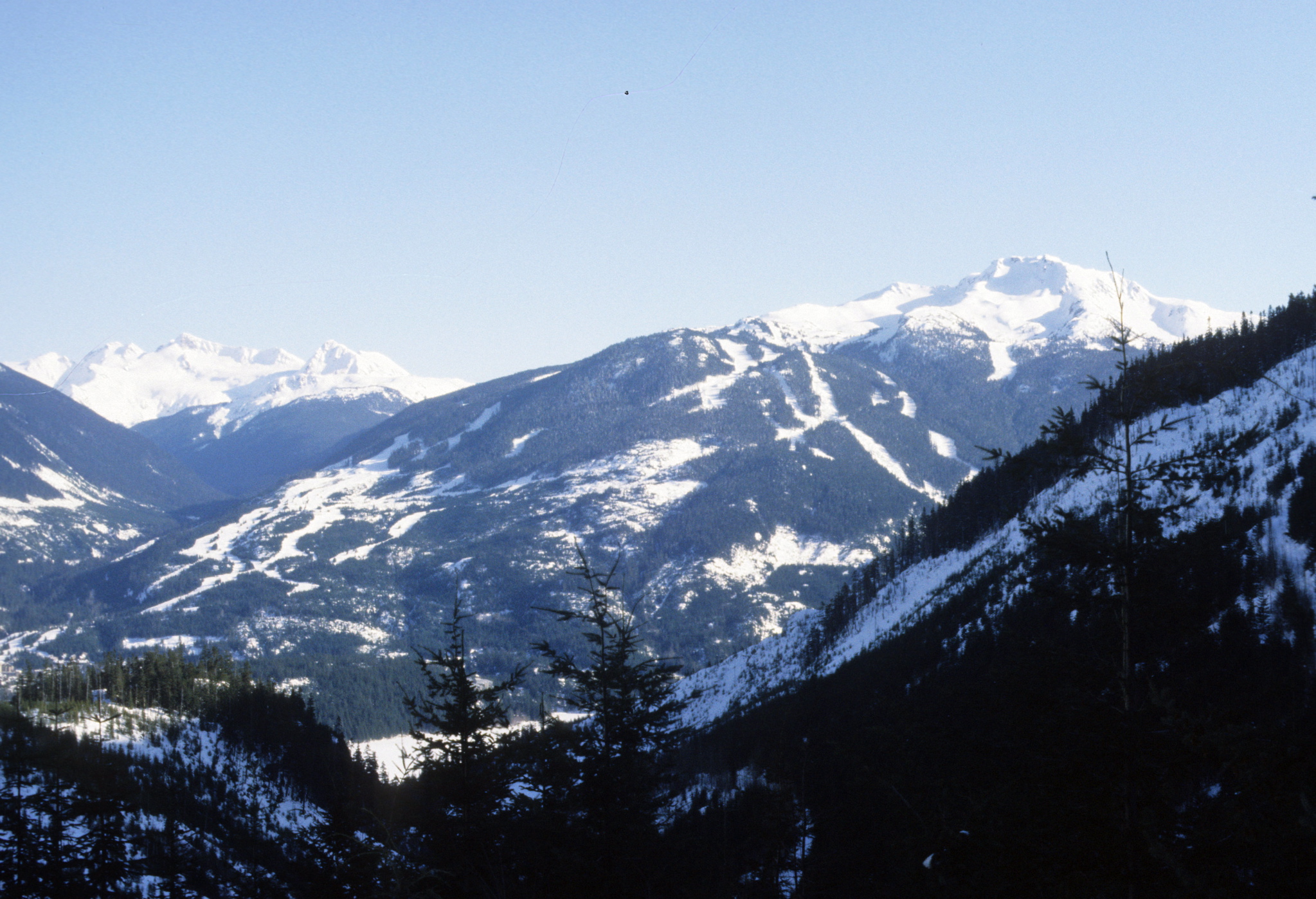 Whistler Mountain